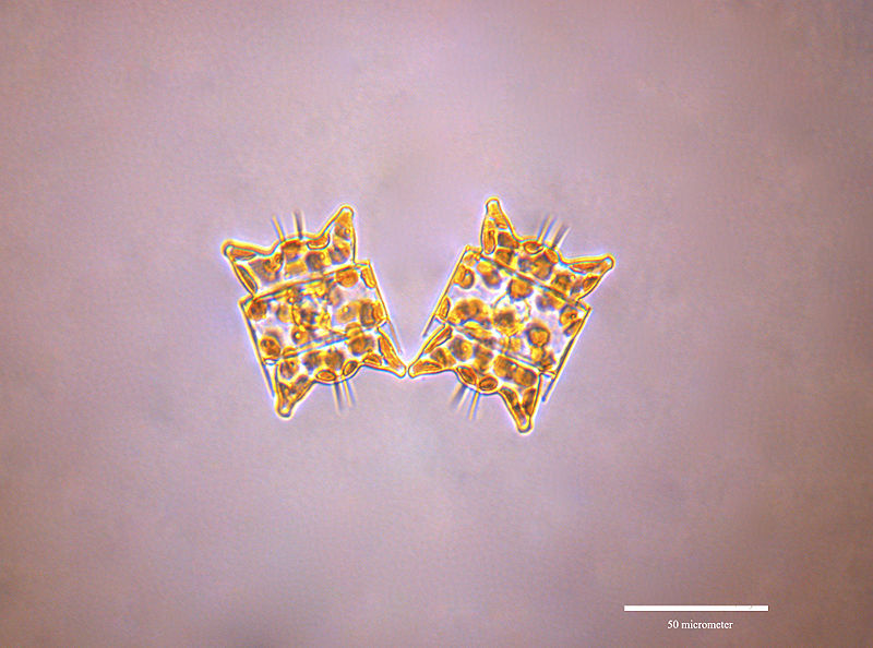 Odontella aurita -crédit photo By Richard A. Ingebrigtsen, Department of Arctic and Marine Biology, University of Tromsø - Own work, CC BY-SA 3.0