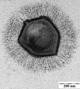 Par Ghigo E, Kartenbeck J, Lien P, Pelkmans L, Capo C, Mege JL, Raoult D. — https://biotechinfo.fr/814 PLoS Pathog. 2008 Jun 13;4(6):e1000087. doi: 10.1371/journal.ppat.1000087, CC BY 2.5, https://commons.wikimedia.org/w/index.php?curid=24820104