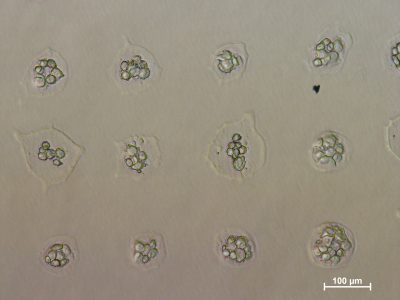 Ces cellules ont été bio-imprimées par la start-up Poeitis grâce à son procédé de bio-impression assistée par laser. © Poietis 2016