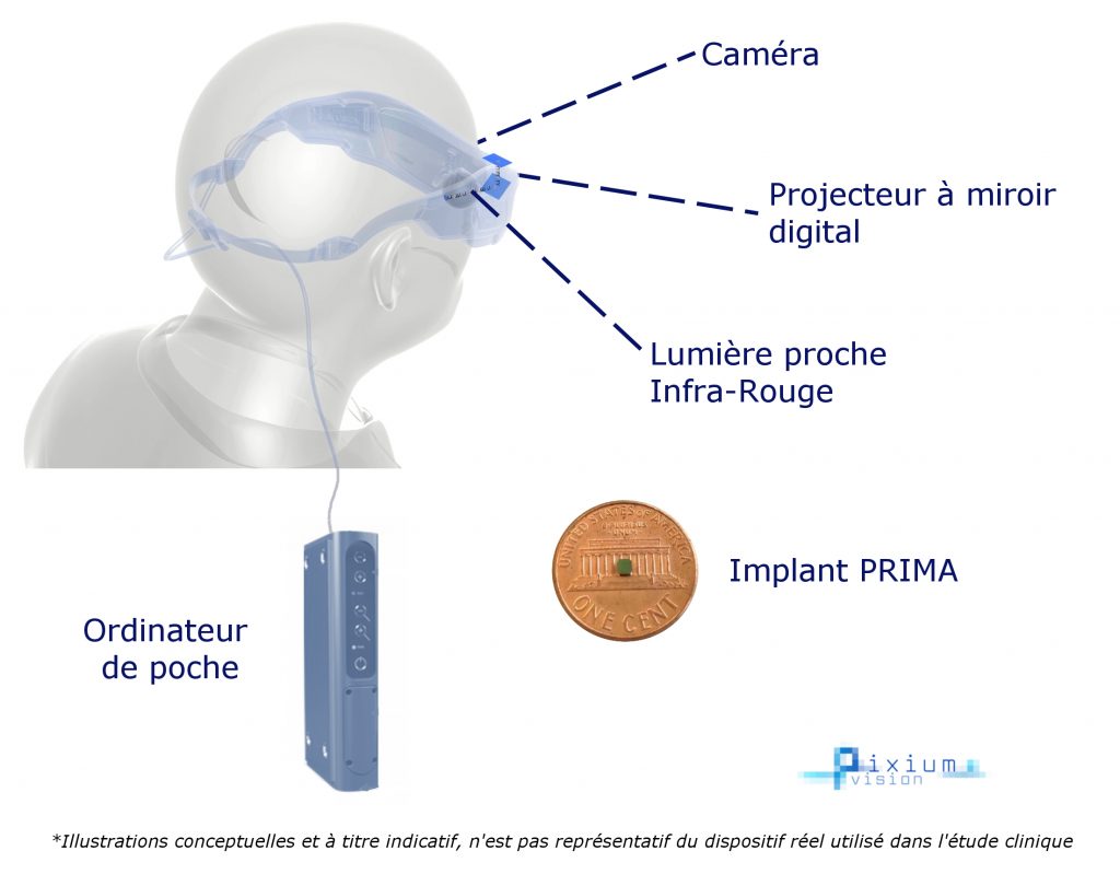 prima-full-concept_fr