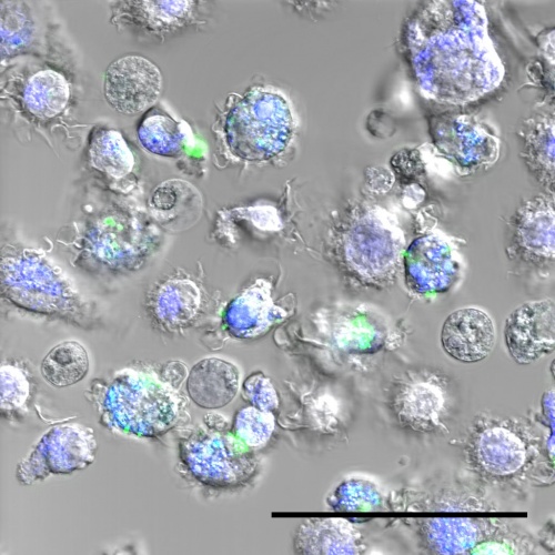 Cellules immunitaires ayant ingéré des nanoparticules de soie d’araignée - en vert. Les endosomes - la partie de la cellule dans laquelle les nanoparticules relâchent le vaccin – apparaissent en bleu. (Illustration © Laboratoire Bourquin – UNIGE.)